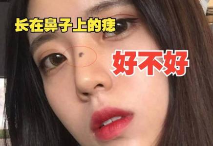 女人鼻梁上有痣，往往夫運不佳？
