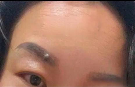 眉毛里有痣的男人命運如何，眉中藏珠運氣好？