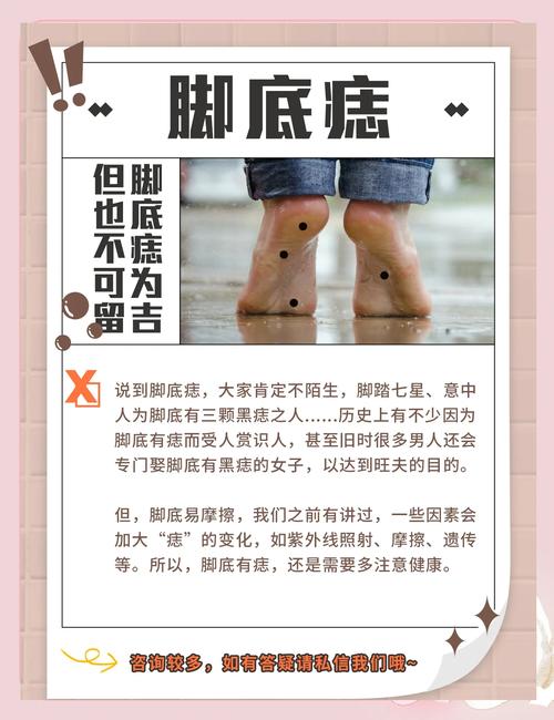 腳底板長痣好不好呢 腳底長痣代表什么