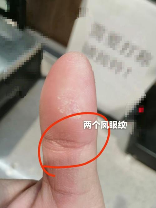 手相大拇指鳳眼紋圖片精選，大拇指鳳眼紋是什么樣子