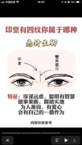 哪種印堂會影響賺大錢