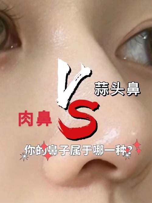 肉鼻子和蒜頭鼻區別