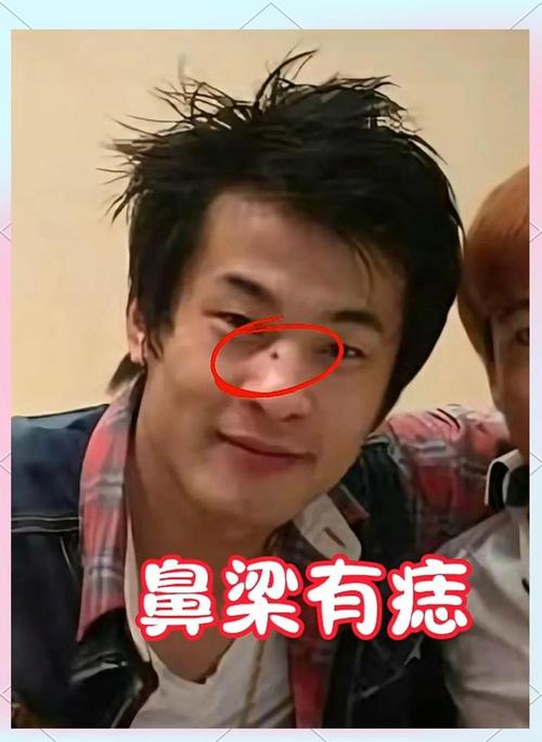 鼻梁上有痣的男人容易招惹爛桃花？