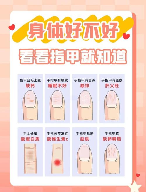 在看手相時要小心指甲的哪些變化?