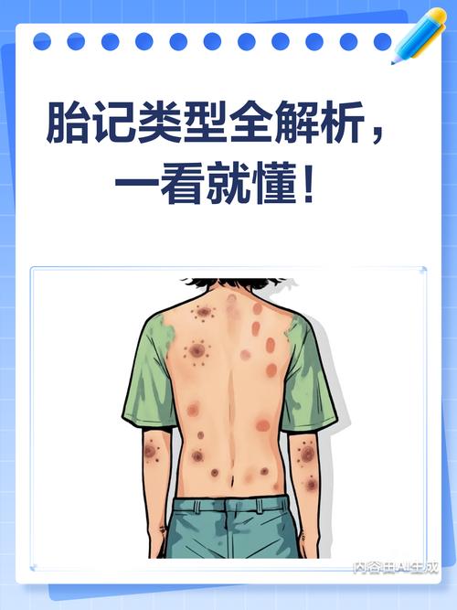 男人有胎記代表什么意思，長在哪里好？