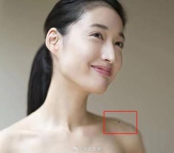 肩膀上長痣的女人凡事要靠自己是真的嗎？