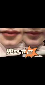 有錢的下巴是什么樣的