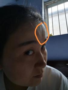 女人額頭上有一條豎線
