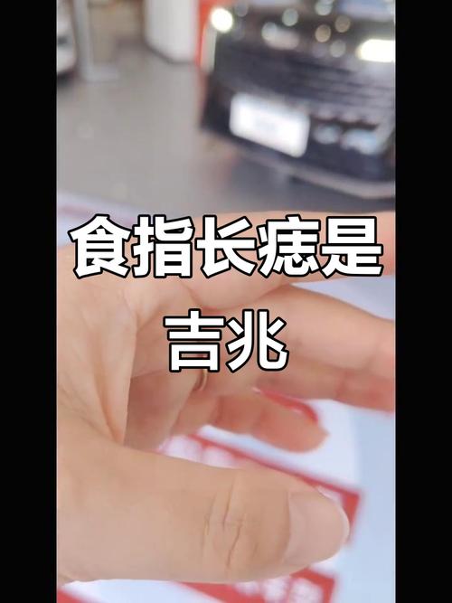 食指有痣的女人左手 事業(yè)發(fā)展好婚姻不如意