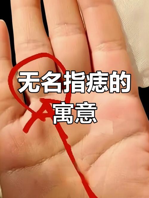 無名指有痣的女人命運(yùn)右手 藝術(shù)之氣質(zhì)財(cái)運(yùn)好