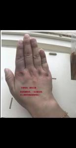手背厚的人是否值得信賴(lài)