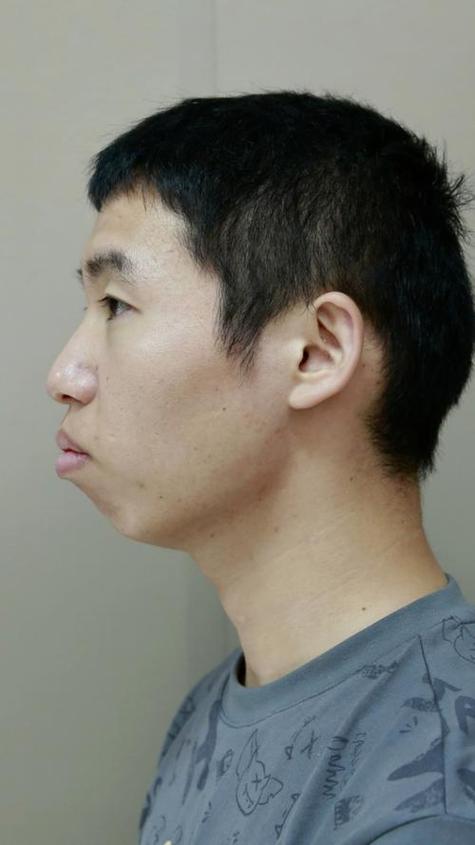 尖嘴男人面相 以自我為中心