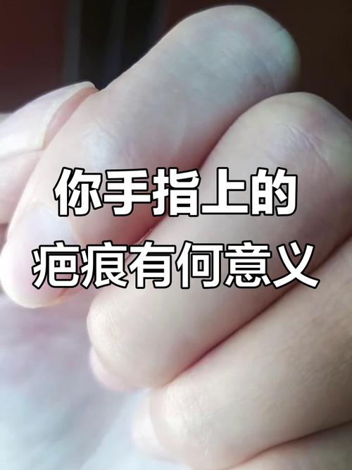 女人手上有疤不能娶 中指有疤痕夫妻常有爭吵