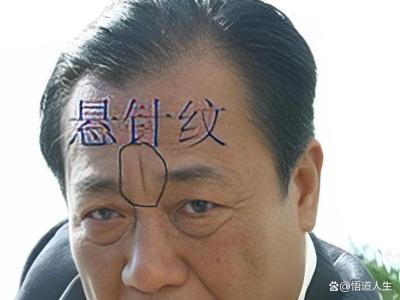 男人眉間有豎紋好不好