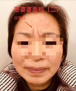 女人印堂有川字紋好不好