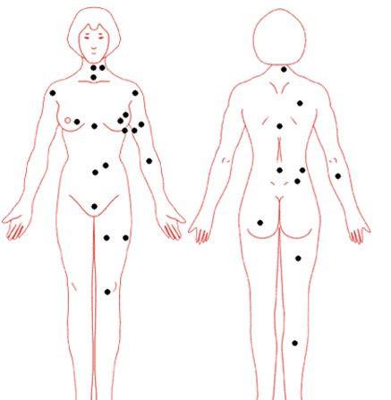 女人背部長(zhǎng)痣代表什么，生活順利煩惱少？