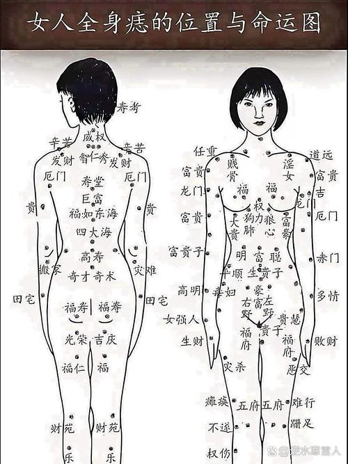 腿部有痣的位置與命運解析，長在哪里比較好？