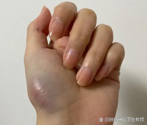 手冒青筋、發冷的人的性格如何?