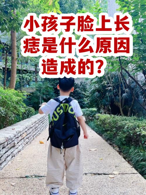 男孩長敗家痣是在哪里