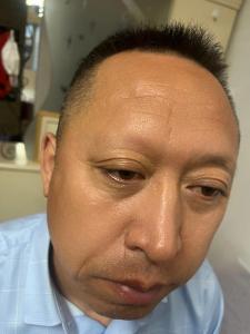 沒有眉毛的人面相分析