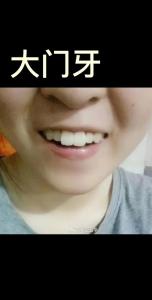 門牙大的女人面相 精力旺盛