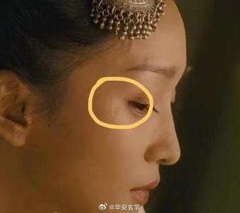 女人夫妻宮有疤一定會婚姻不順嗎
