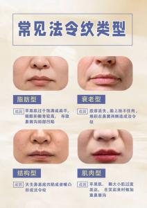 有法令紋的人比較有威信嗎
