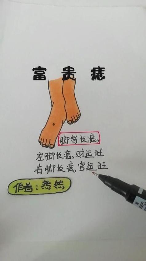 志在他鄉的男人腳面長痣圖解