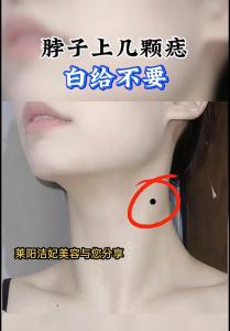 脖子有痣好不好，不同部位有什么代表意思