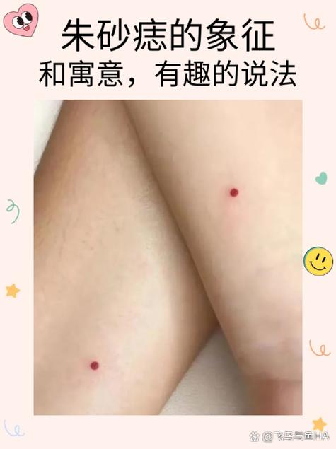朱砂痣的寓意 不同部位朱砂痣的含義