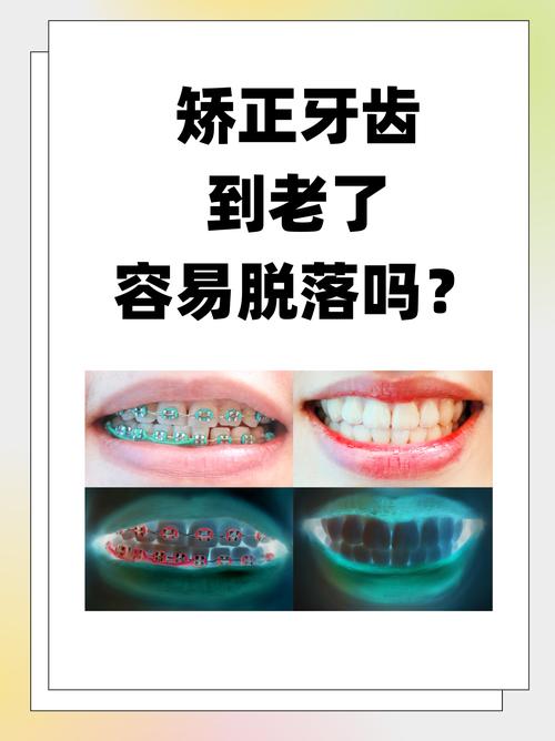 整牙對命運的影響 改變運勢嗎