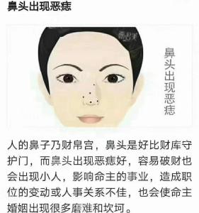 鼻子右側的痣,鼻子右邊有痣好不好