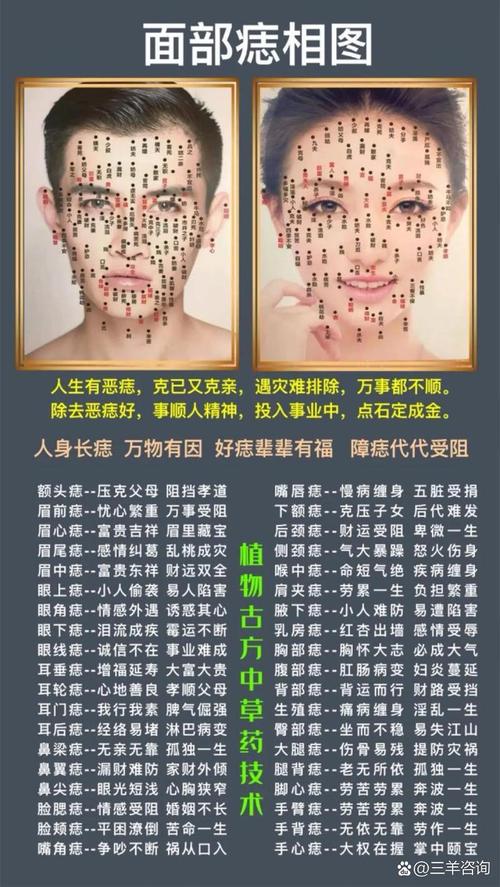 頭發里長痣代表什么 頭發中有痣在哪個位置好代表什么