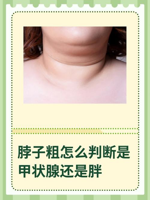 脖子粗的女人命運(yùn)如何