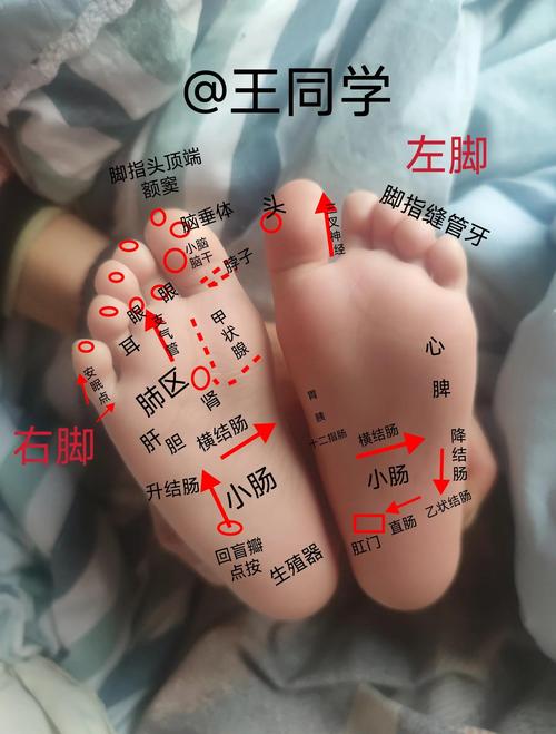 男右腳底長痣好不好 男人腳底足底有痣相代表什么圖解