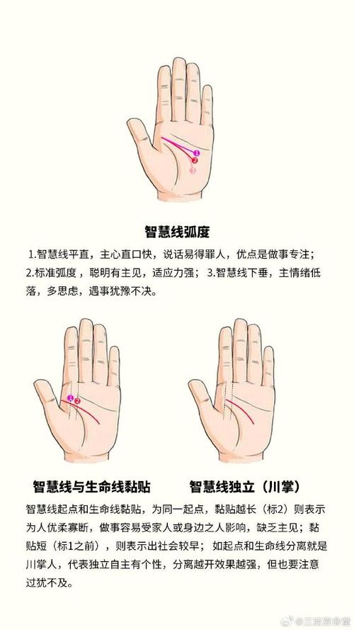 智慧線下垂是什么意思