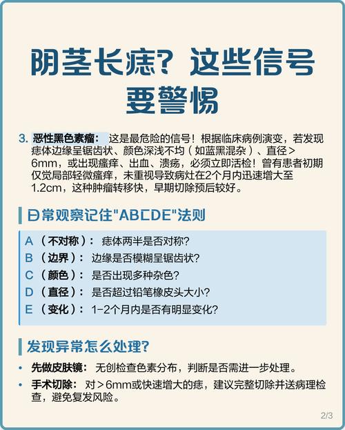 男人龜頭上有痣是代表什么含義 龜頭長痣什么寓意嗎好不好