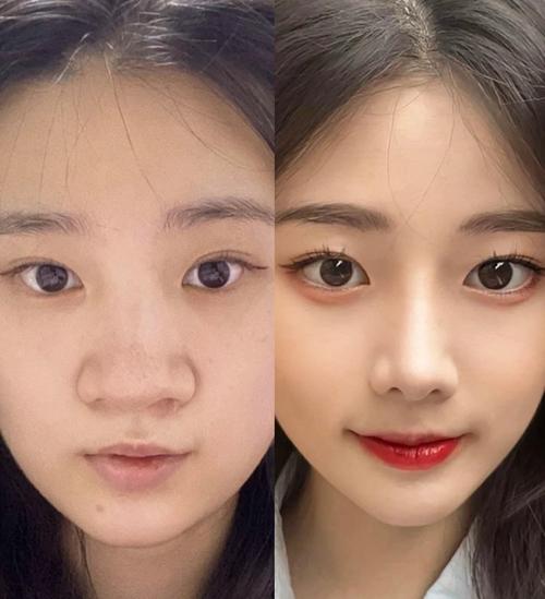 面相塌鼻子沒有好命嗎 塌鼻子是不是沒財運