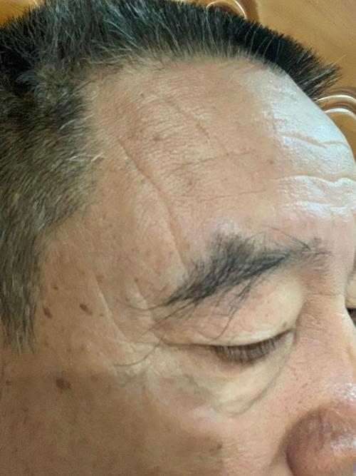 額頭有皺紋，額頭上有皺紋