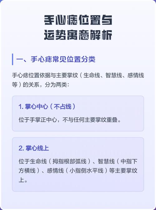 女人左手心長痣圖解 分析女人左手掌心有痣的含義