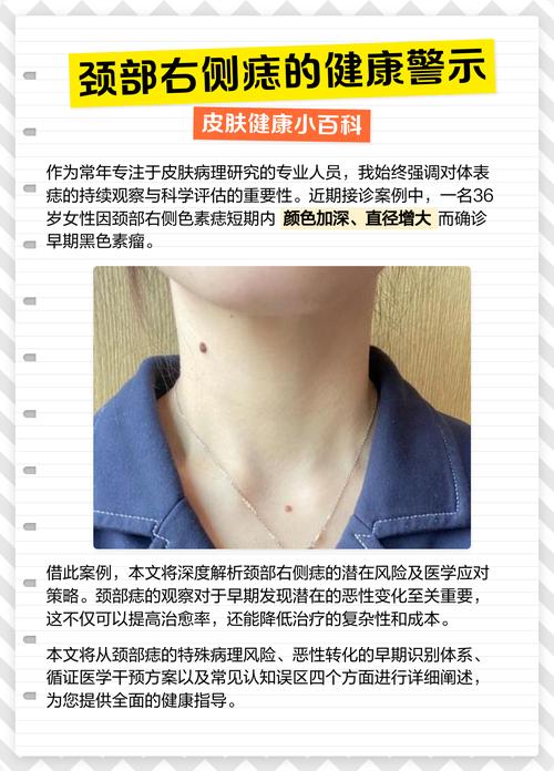 女人脖子上右側邊長黑痣好不好 左邊前脖子頸部有痣的女人好嗎