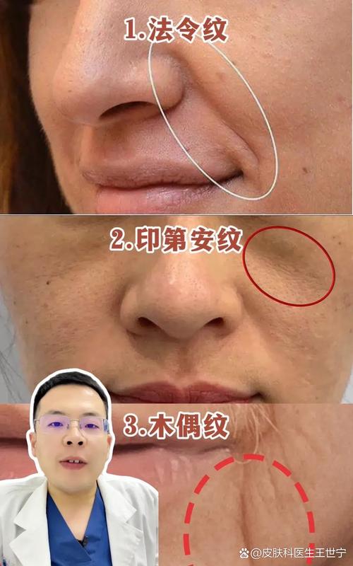 會讓你走衰運的面部皺紋