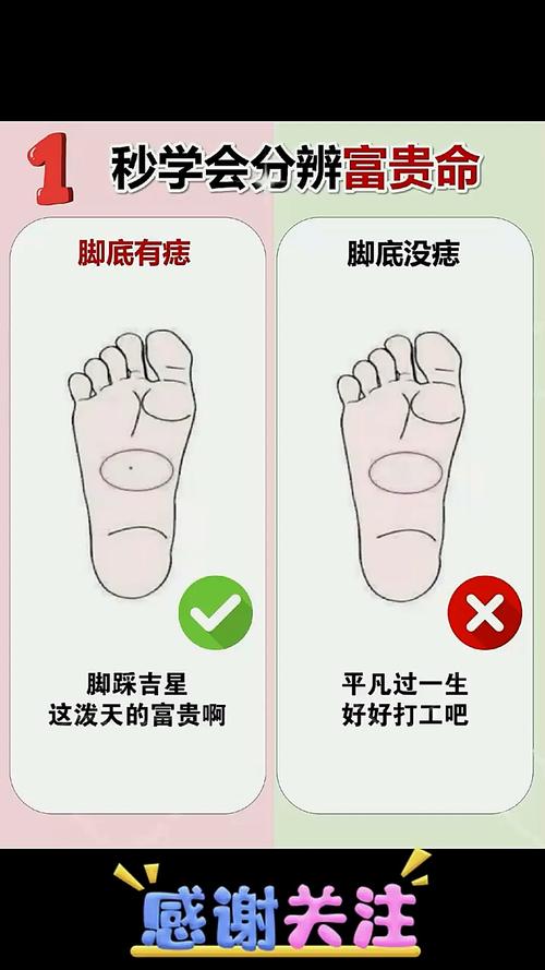 小腳趾長痣代表什么 小腳趾上有痣代表什么