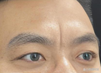 男人眉間一道很深的豎紋好嗎 豎紋的種類