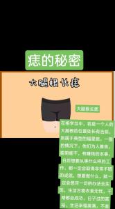 大腿根上有長痣好不好圖解 大腿外側有長痣代表什么
