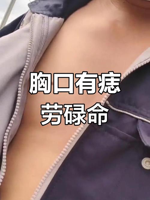 胸部中間長(zhǎng)痣的男人“得善妻”？