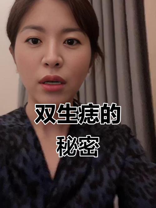 人中有痣生雙胎說法正確嗎