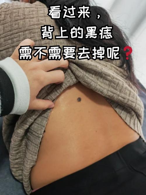 背上長(zhǎng)痣的女人是大叔控？