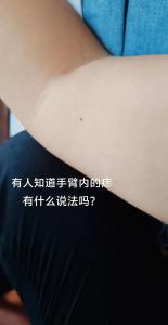 右手臂內側有痣的女人