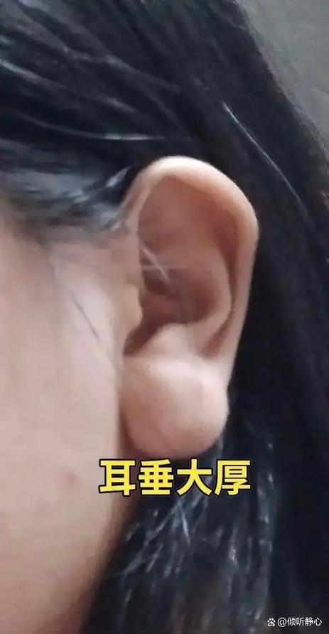 富貴耳朵是什么樣子 怎么看